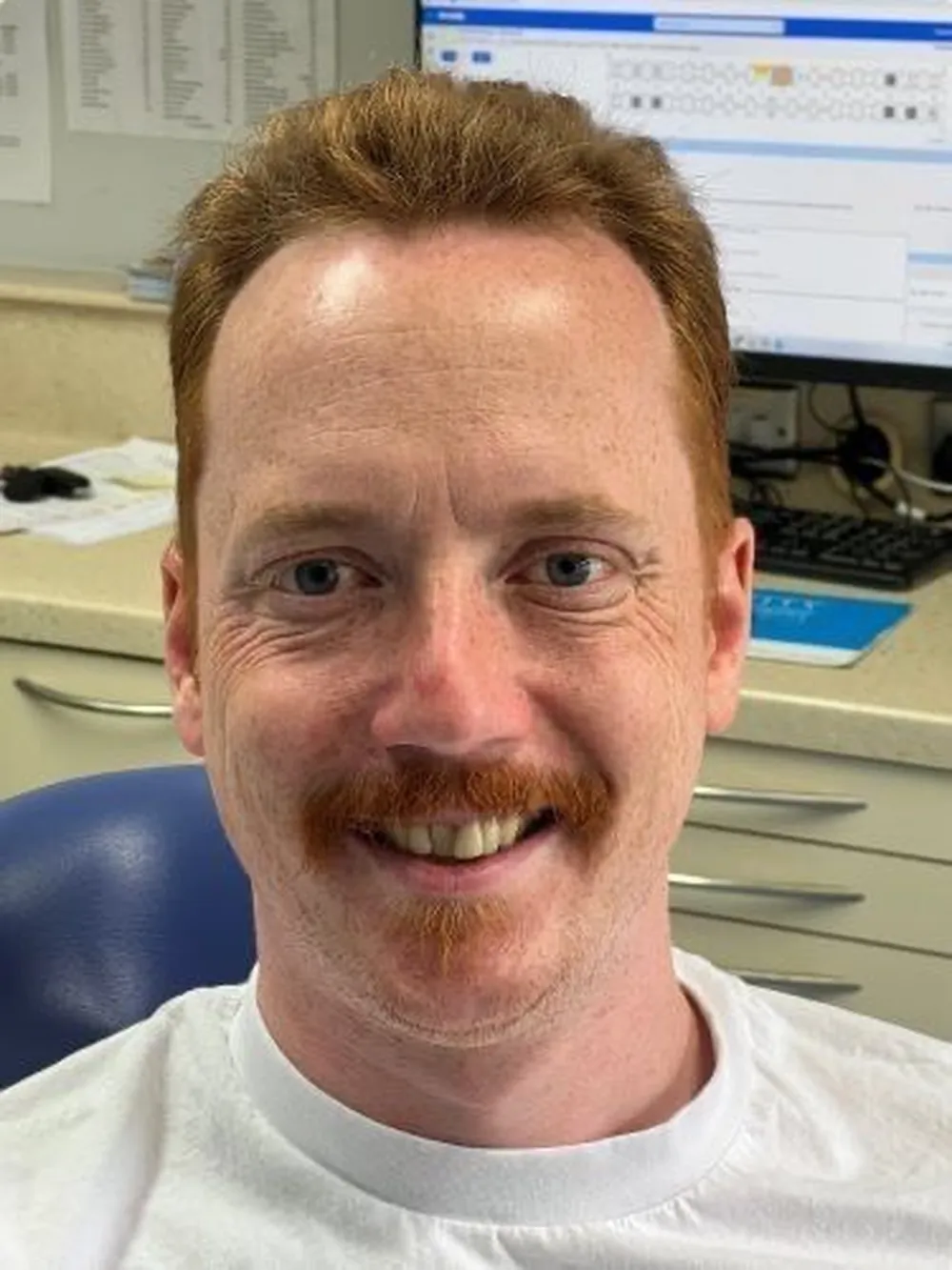 A patient's smile before Invisalign, showing gaps between the front teeth
